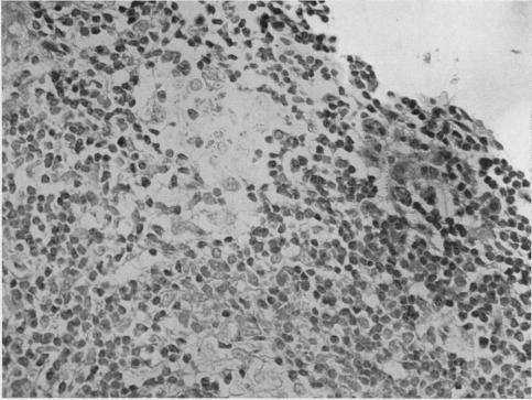 https://cdn.ncbi.nlm.nih.gov/pmc/blobs/d12c/1030864/f711a063eecd/annrheumd00208-0024-a.jpg