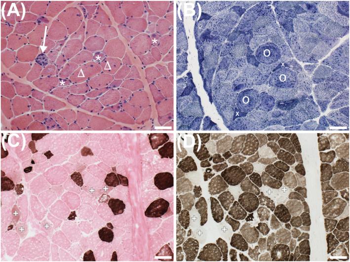 https://cdn.ncbi.nlm.nih.gov/pmc/blobs/d12c/8818659/c493efea9b2f/JCSM-13-11-g001.jpg