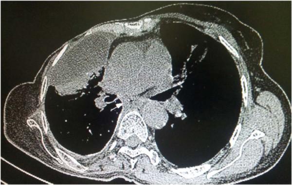 https://cdn.ncbi.nlm.nih.gov/pmc/blobs/d12d/3480838/09b91d1fad36/1756-0500-5-426-1.jpg