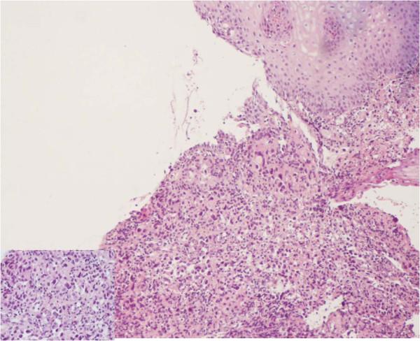 https://cdn.ncbi.nlm.nih.gov/pmc/blobs/d12d/3480838/0d0b8167f305/1756-0500-5-426-2.jpg