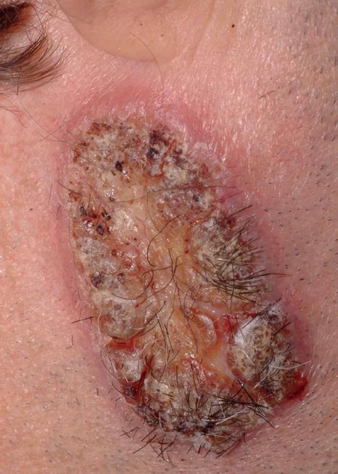 https://cdn.ncbi.nlm.nih.gov/pmc/blobs/d130/6668951/b9be9f3320c3/abd-94-03-0355-g02.jpg