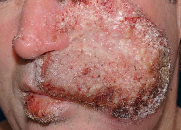 https://cdn.ncbi.nlm.nih.gov/pmc/blobs/d130/6668951/e006bdc654fd/abd-94-03-0355-g01.jpg