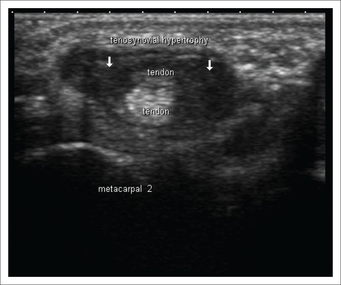 https://cdn.ncbi.nlm.nih.gov/pmc/blobs/d135/6837821/33e977c94c4a/SAJR-22-1316-g002.jpg