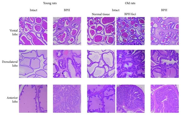 https://cdn.ncbi.nlm.nih.gov/pmc/blobs/d136/6589250/ca33ee6bf2e7/IJG2019-8173630.001.jpg