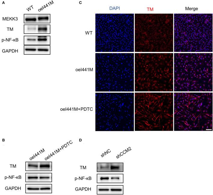 https://cdn.ncbi.nlm.nih.gov/pmc/blobs/d13c/9458974/c84db0e64e11/fneur-13-946324-g0003.jpg