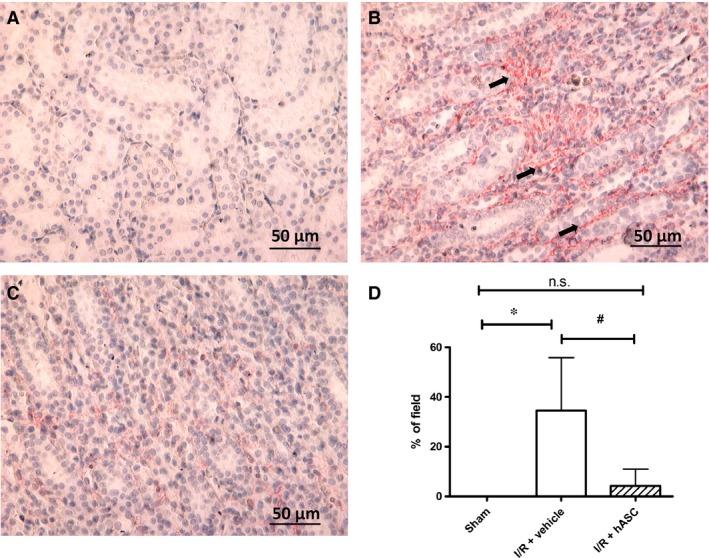 https://cdn.ncbi.nlm.nih.gov/pmc/blobs/d13d/5487924/65893eea4c4a/JCMM-21-1420-g006.jpg
