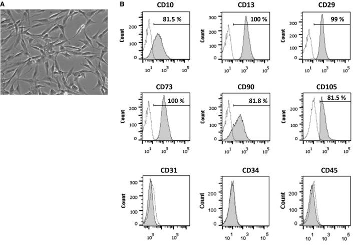 https://cdn.ncbi.nlm.nih.gov/pmc/blobs/d13d/5487924/b6c5b07bb6c1/JCMM-21-1420-g001.jpg