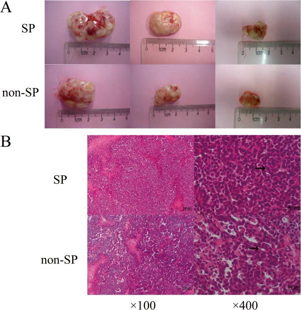 https://cdn.ncbi.nlm.nih.gov/pmc/blobs/d140/3907367/4cff46e2a107/1475-2867-14-3-5.jpg