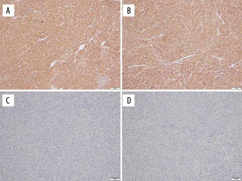 https://cdn.ncbi.nlm.nih.gov/pmc/blobs/d14b/12101094/ac94bd9aeccc/amjcaserep-26-e947545-g005.jpg