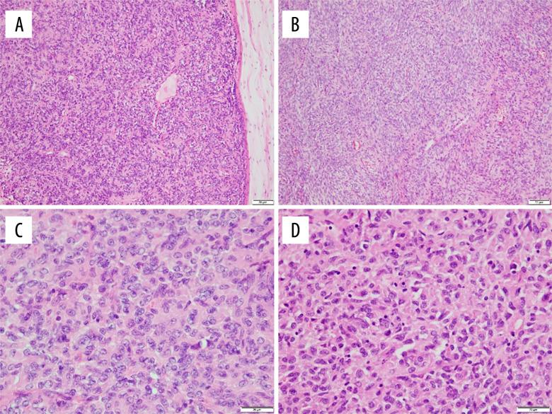 https://cdn.ncbi.nlm.nih.gov/pmc/blobs/d14b/12101094/dbb6054f5634/amjcaserep-26-e947545-g004.jpg