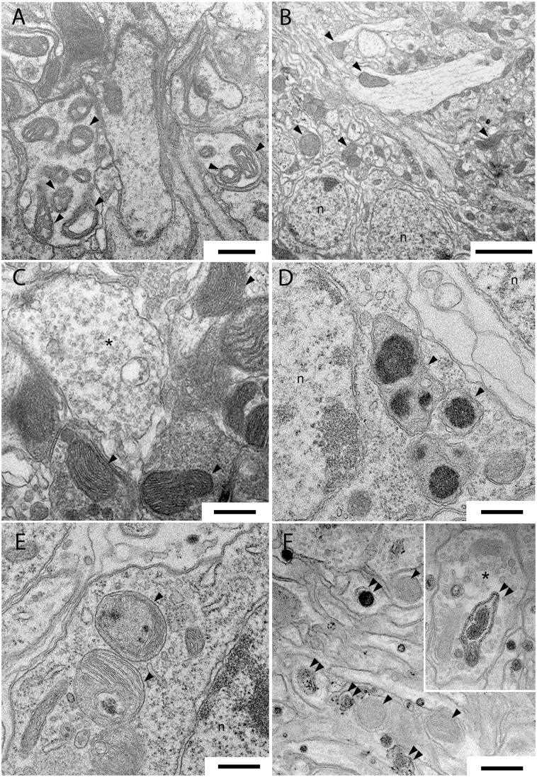 https://cdn.ncbi.nlm.nih.gov/pmc/blobs/d15a/4699764/4e545d3d1b3b/pone.0146140.g005.jpg