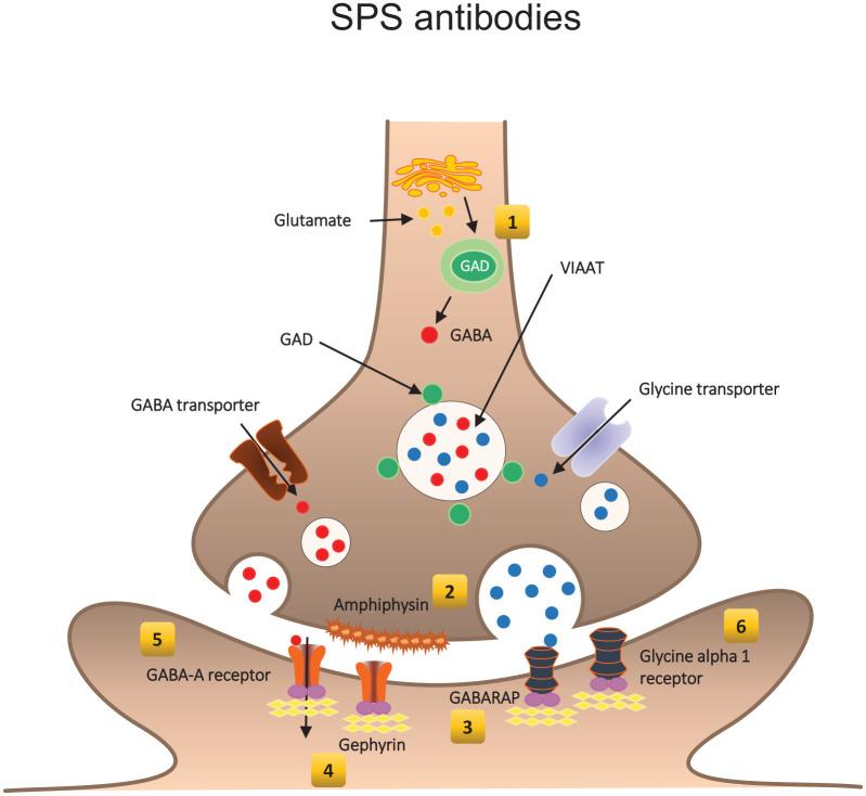 https://cdn.ncbi.nlm.nih.gov/pmc/blobs/d15a/8013924/f4210807f734/10.1177_17562864211003486-fig2.jpg
