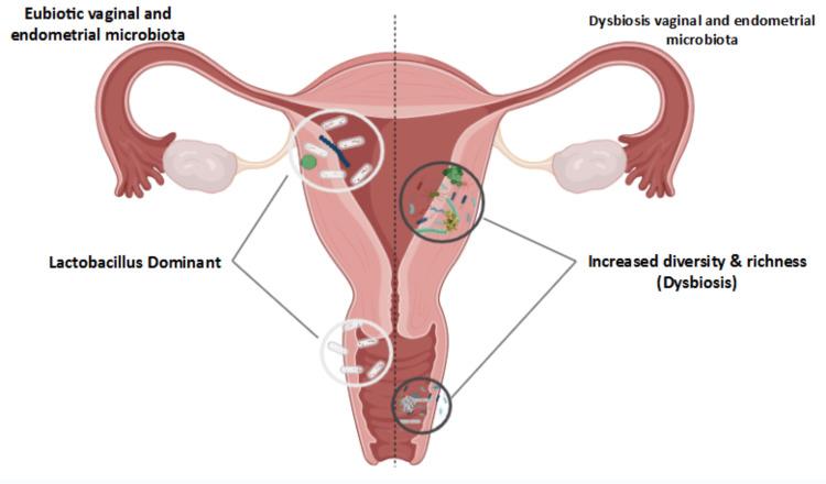 https://cdn.ncbi.nlm.nih.gov/pmc/blobs/d15e/12016387/f361aabd4bff/cureus-0017-00000081067-i01.jpg
