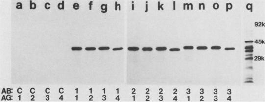 https://cdn.ncbi.nlm.nih.gov/pmc/blobs/d15f/261287/7c6eefc5ac2c/iai00114-0369-a.jpg