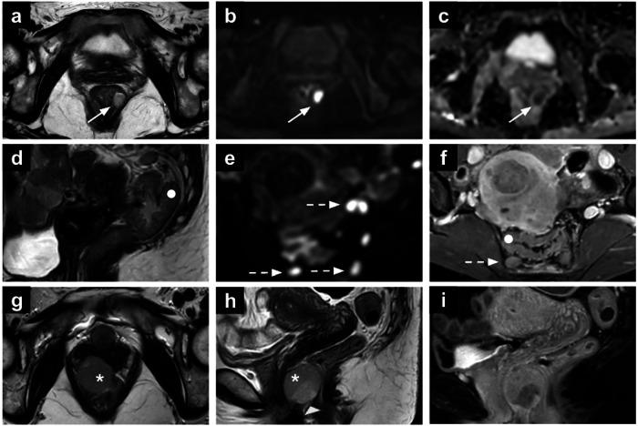 https://cdn.ncbi.nlm.nih.gov/pmc/blobs/d161/12204973/43160c1d685f/13244_2025_2006_Fig7_HTML.jpg