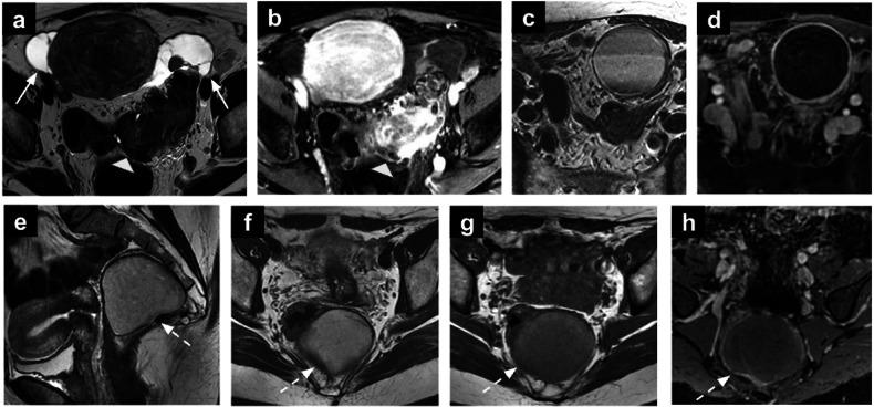 https://cdn.ncbi.nlm.nih.gov/pmc/blobs/d161/12204973/a103a5660a3f/13244_2025_2006_Fig6_HTML.jpg