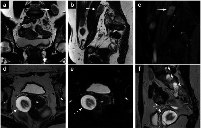 https://cdn.ncbi.nlm.nih.gov/pmc/blobs/d161/12204973/ca74606eaacb/13244_2025_2006_Fig3_HTML.jpg