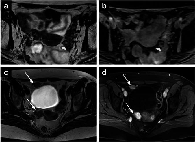 https://cdn.ncbi.nlm.nih.gov/pmc/blobs/d161/12204973/ea5bd65cebf9/13244_2025_2006_Fig11_HTML.jpg