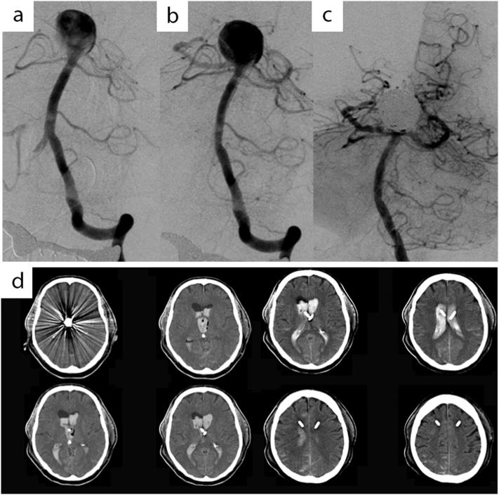 https://cdn.ncbi.nlm.nih.gov/pmc/blobs/d166/5933999/2af30bff9459/gr3.jpg