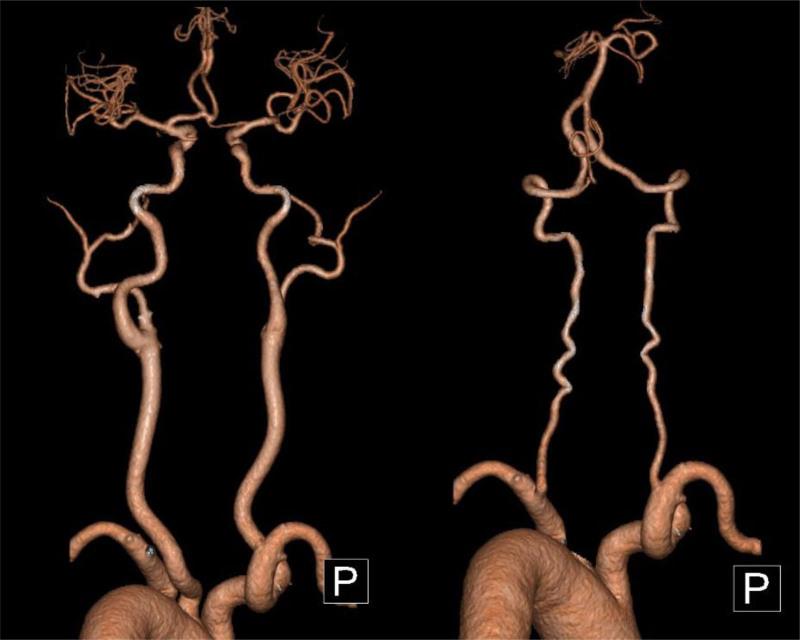 https://cdn.ncbi.nlm.nih.gov/pmc/blobs/d168/12114012/e2ded7d41af7/medi-104-e42520-g003.jpg