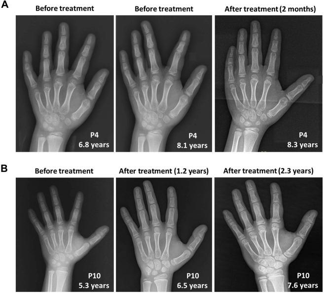 https://cdn.ncbi.nlm.nih.gov/pmc/blobs/d16b/10070943/f9631767361b/fgene-14-1085210-g003.jpg