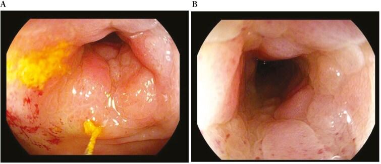 https://cdn.ncbi.nlm.nih.gov/pmc/blobs/d177/12087567/568fcae174fd/jjae174_fig6.jpg