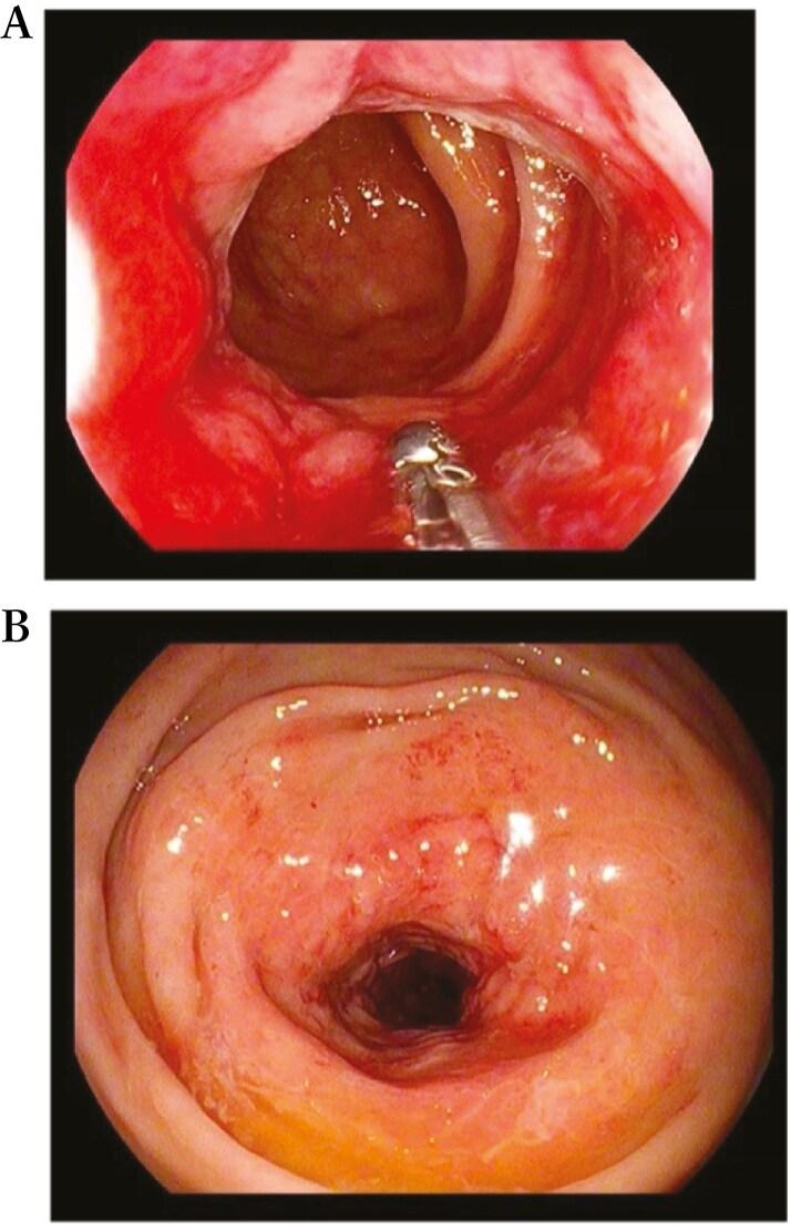 https://cdn.ncbi.nlm.nih.gov/pmc/blobs/d177/12087567/723933b0f939/jjae174_fig5.jpg