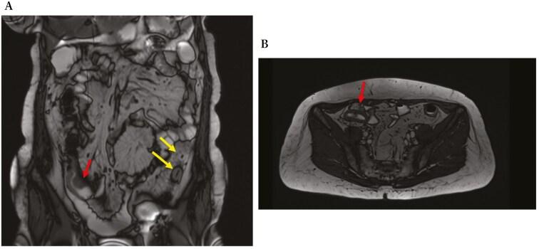 https://cdn.ncbi.nlm.nih.gov/pmc/blobs/d177/12087567/8efb22867fca/jjae174_fig3.jpg