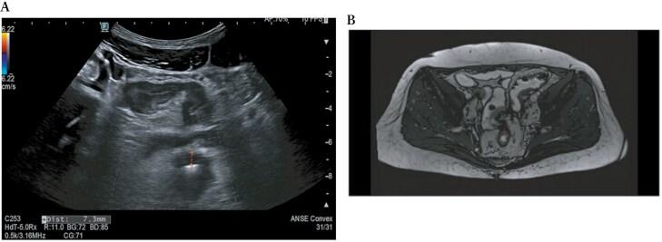 https://cdn.ncbi.nlm.nih.gov/pmc/blobs/d177/12087567/987661e1669c/jjae174_fig4.jpg