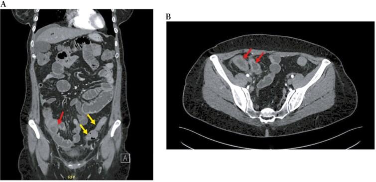 https://cdn.ncbi.nlm.nih.gov/pmc/blobs/d177/12087567/a619066c9720/jjae174_fig1.jpg