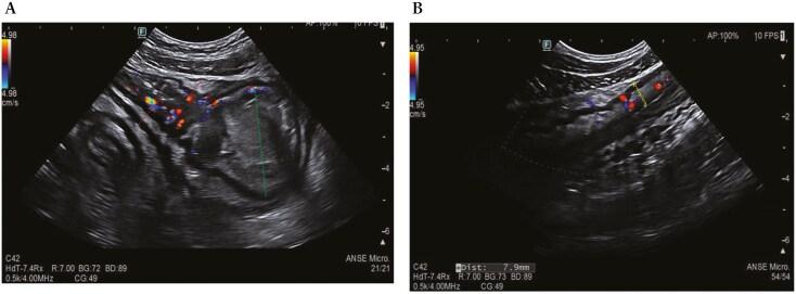 https://cdn.ncbi.nlm.nih.gov/pmc/blobs/d177/12087567/eb2977983ec9/jjae174_fig2.jpg