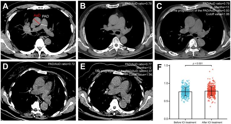 https://cdn.ncbi.nlm.nih.gov/pmc/blobs/d178/10859503/3791ac830fef/fimmu-15-1302233-g001.jpg