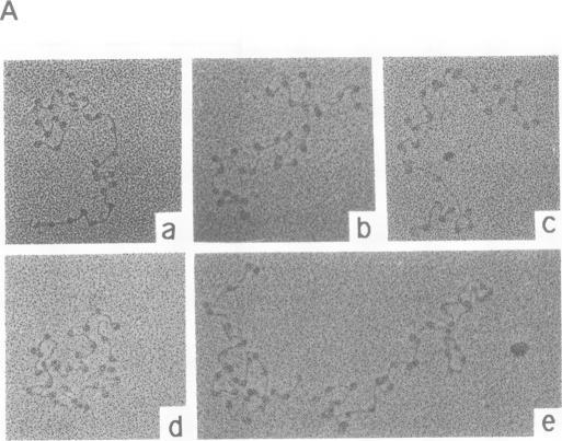 https://cdn.ncbi.nlm.nih.gov/pmc/blobs/d188/333861/556472e28c06/nar00242-0158-a.jpg