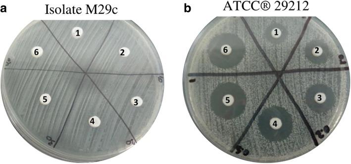 https://cdn.ncbi.nlm.nih.gov/pmc/blobs/d189/6267012/ae0971cad34a/12917_2018_1692_Fig2_HTML.jpg