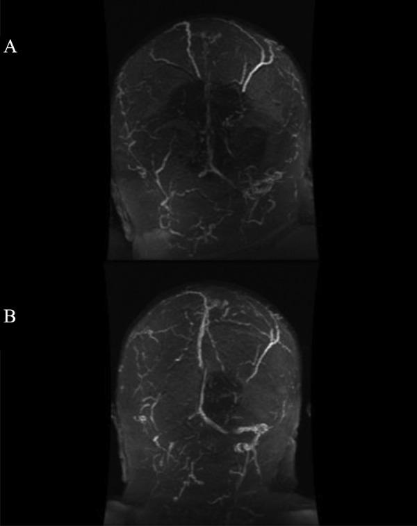 https://cdn.ncbi.nlm.nih.gov/pmc/blobs/d18b/8328578/bc586ef06eb4/gr2_lrg.jpg