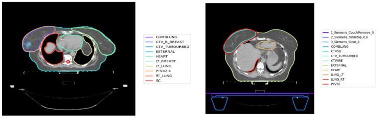 https://cdn.ncbi.nlm.nih.gov/pmc/blobs/d190/9913464/d8c4ab9feaa9/cancers-15-00564-g001.jpg