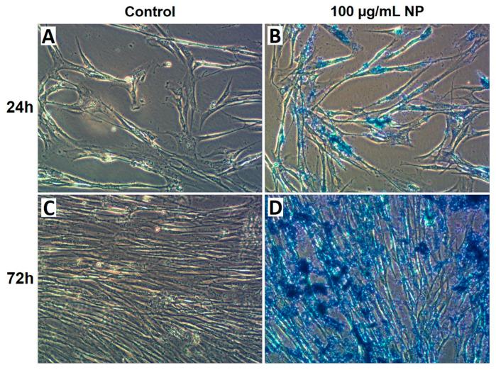 https://cdn.ncbi.nlm.nih.gov/pmc/blobs/d192/11430180/4daa33293bb0/cancers-16-03239-g002.jpg