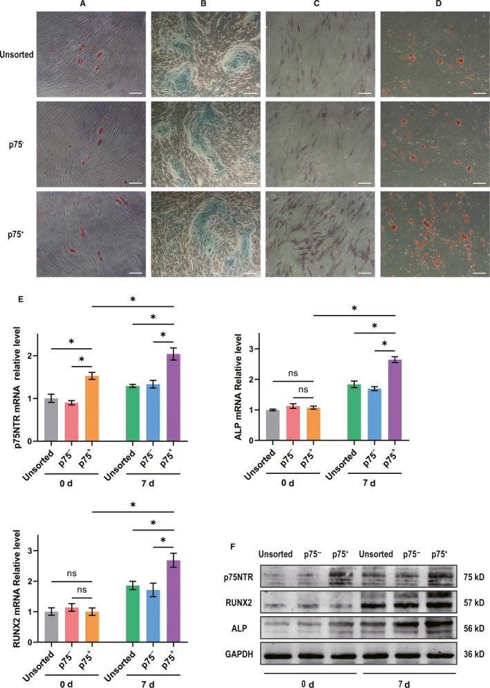 https://cdn.ncbi.nlm.nih.gov/pmc/blobs/d195/7339167/e98d2c8f5e10/JCMM-24-7563-g004.jpg