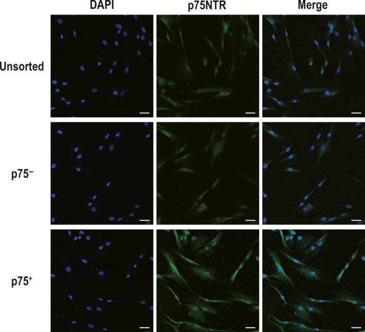 https://cdn.ncbi.nlm.nih.gov/pmc/blobs/d195/7339167/edab4837034d/JCMM-24-7563-g003.jpg