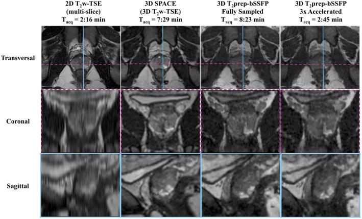 https://cdn.ncbi.nlm.nih.gov/pmc/blobs/d196/6563534/65a032207aef/MRM-82-721-g005.jpg