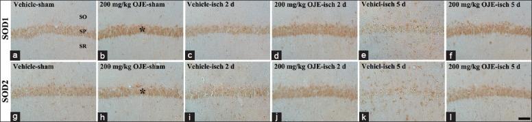 https://cdn.ncbi.nlm.nih.gov/pmc/blobs/d198/4756874/02fbb3dcd16b/CMJ-128-2932-g002.jpg