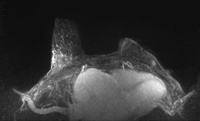 https://cdn.ncbi.nlm.nih.gov/pmc/blobs/d1a2/12034744/11b3ef24cf8f/CCR3-13-e70458-g005.jpg