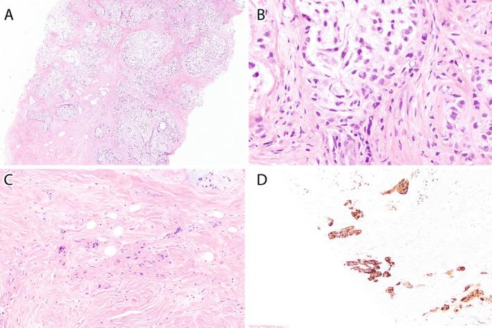 https://cdn.ncbi.nlm.nih.gov/pmc/blobs/d1a2/12034744/9a889c0d274d/CCR3-13-e70458-g001.jpg