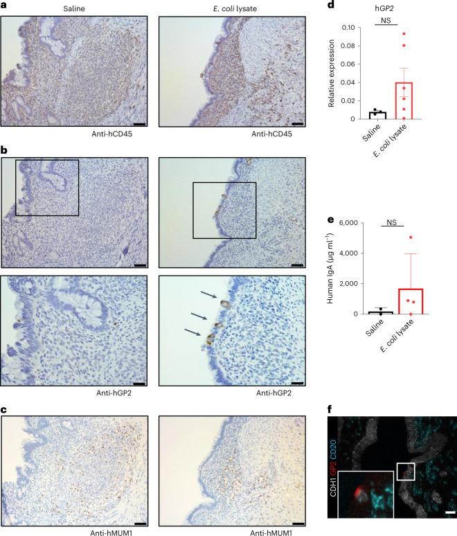 https://cdn.ncbi.nlm.nih.gov/pmc/blobs/d1a7/10264243/6083507c43b5/41587_2022_1558_Fig5_HTML.jpg