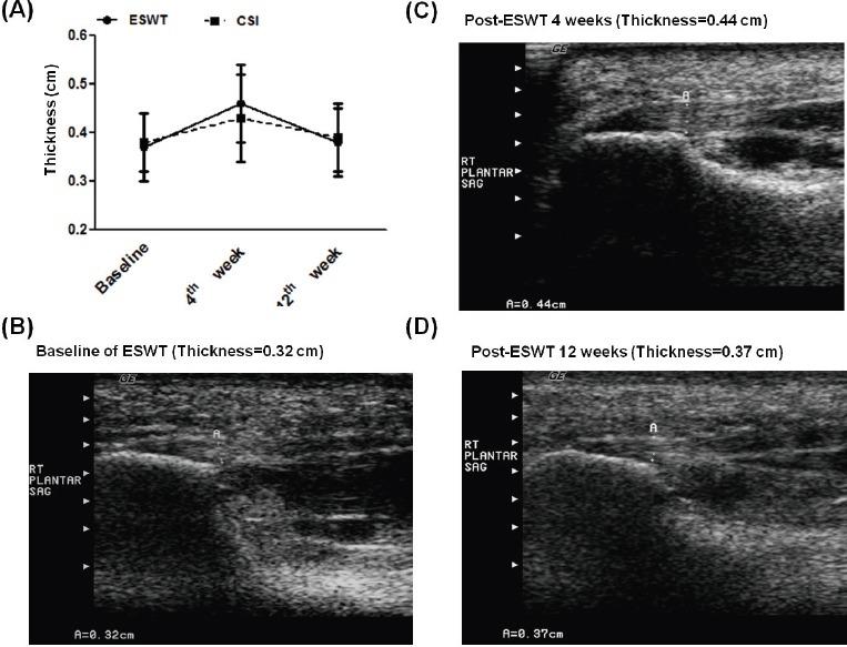 https://cdn.ncbi.nlm.nih.gov/pmc/blobs/d1aa/5881128/b0b384f4bb1f/JMNI-18-047-g001.jpg