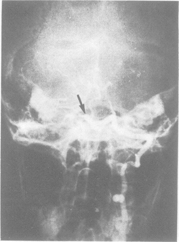 https://cdn.ncbi.nlm.nih.gov/pmc/blobs/d1ad/1031894/698f61cd9b71/jnnpsyc00551-0120-a.jpg