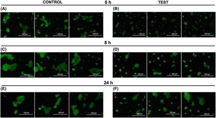 https://cdn.ncbi.nlm.nih.gov/pmc/blobs/d1b8/12319701/0469879f8ddb/FEB4-15-1365-g001.jpg