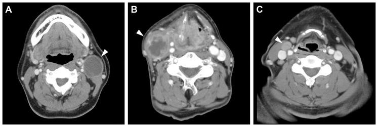 https://cdn.ncbi.nlm.nih.gov/pmc/blobs/d1ba/3994055/9fe77fb890f7/pone.0095364.g001.jpg