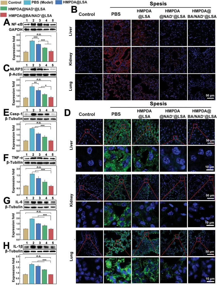 https://cdn.ncbi.nlm.nih.gov/pmc/blobs/d1c0/10190643/109479d0d023/ADVS-10-2207448-g010.jpg