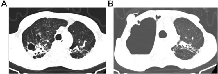 https://cdn.ncbi.nlm.nih.gov/pmc/blobs/d1c4/12206908/6c64ba1d1af1/IDR-18-3103-g0003.jpg